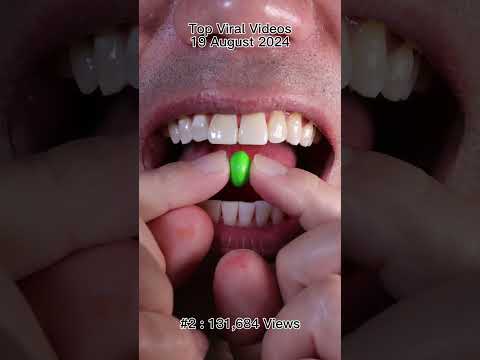 Satisfying Chewing ASMR #Compilation #ASMR #DoctorTristanPeh thumbnail