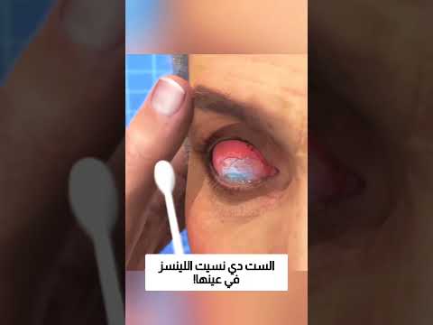 الست دي نسيت اللينسز في عينها! thumbnail