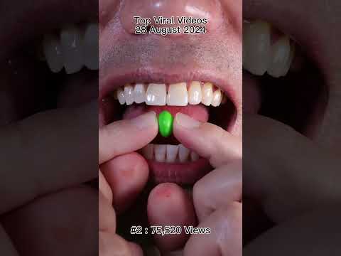 Satisfying Chewing ASMR #Compilation #ASMR #DoctorTristanPeh thumbnail