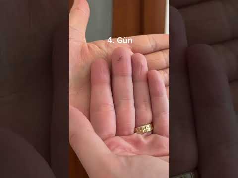On beş günde böyle bir büyüme beklemiyordum, şaşırdım 🥹 thumbnail