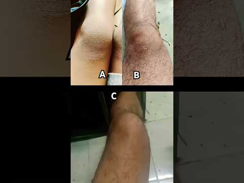 Tutorial youtube zoom #shorts thumbnail