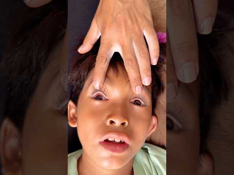 Bego di tinggal tidur dapi thumbnail