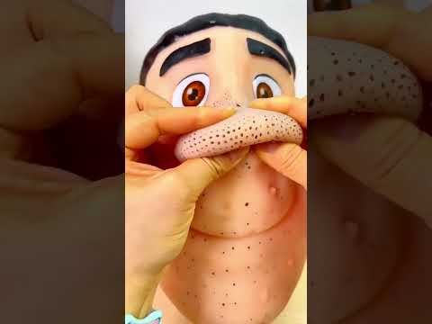 Rahatlatıcı mı, RAHATSIZ Edici Mi? 👃⚫ thumbnail
