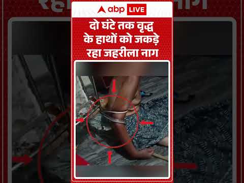 Viral Video  : दो घंटे तक वृद्ध के हाथों को जकड़े रहा जहरीला नाग| Sanke In Hand | Latest | #shorts thumbnail