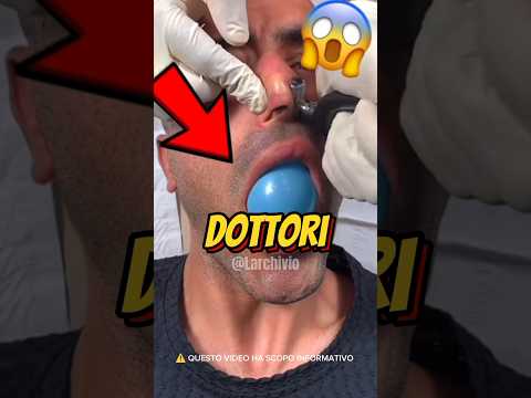 PERCHÉ I DOTTORI GONFIANO UN PALLONCINO NELLA BOCCA DEI PAZIENTI? 😱 #curiosità #informative thumbnail