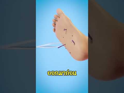 เมื่อเผลอไปเหยียบหอยเม่น!! thumbnail
