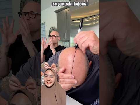 Buat Garis di KEPALA‼️ petesciarrinojr9782 thumbnail