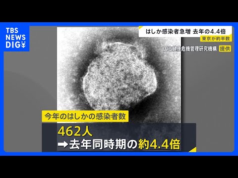 はしか感染者数462人　東京都が半分ほど占める｜TBS NEWS DIG thumbnail