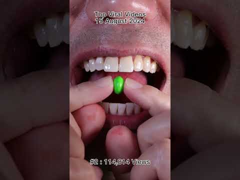 Satisfying Chewing ASMR #Compilation #ASMR #DoctorTristanPeh thumbnail