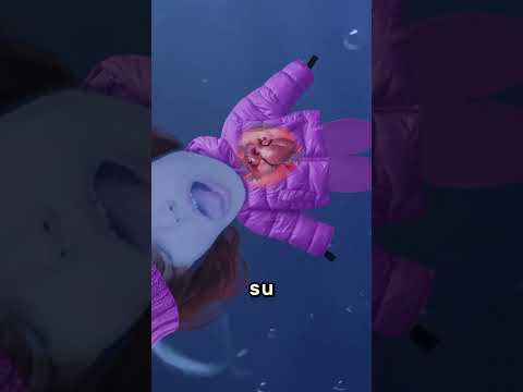 Mujer Cae En Hielo 😨 thumbnail