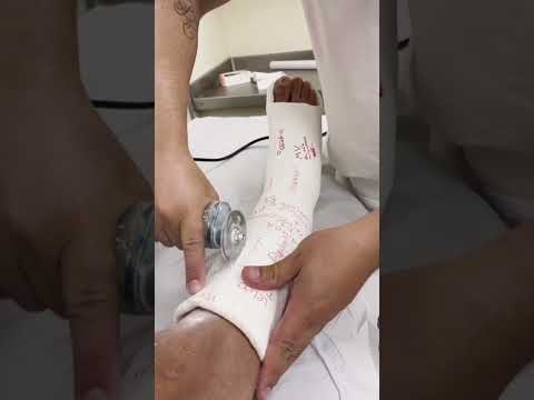 Cast Saw Explained thumbnail
