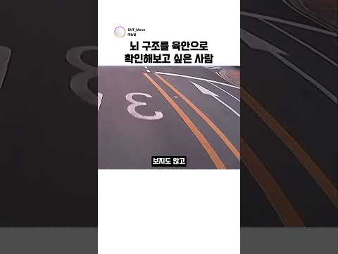 뇌 구조를 육안으로 확인해보고 싶은 사람 #블랙박스 thumbnail