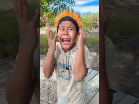 Si botak thumbnail