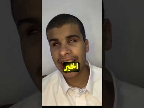 هل الكفيف يشوف الاحلام؟ 🤔 thumbnail