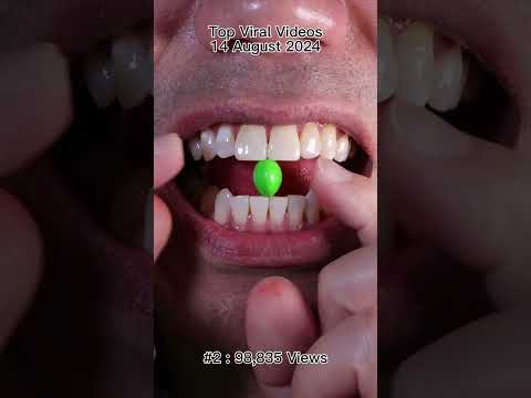 Satisfying Chewing ASMR #Compilation #ASMR #DoctorTristanPeh thumbnail
