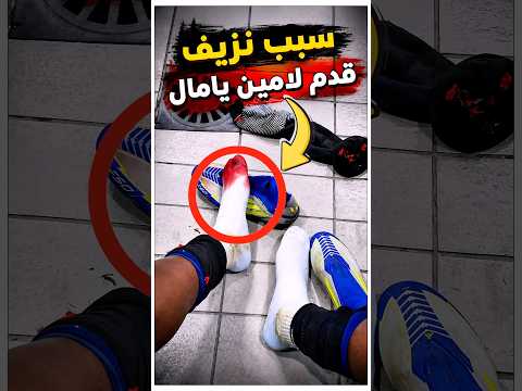 السبب المرعب وراء نزيف قدم لامين يامال 😳🩸 thumbnail