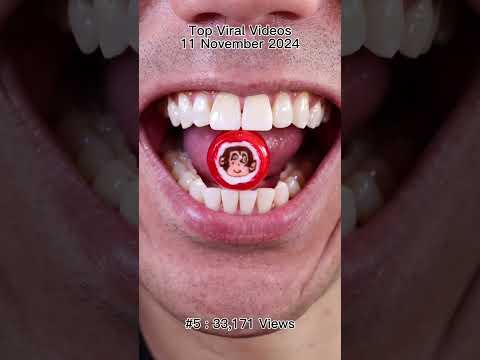Satisfying Chewing ASMR #Compilation #ASMR #DoctorTristanPeh thumbnail