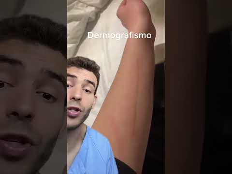 Dermografismo #datoscurisos #piel #sabiasque thumbnail