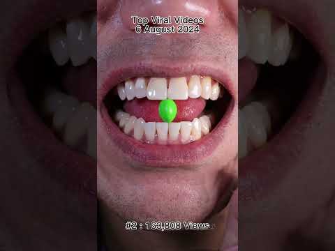 Satisfying Chewing ASMR #Compilation #ASMR #DoctorTristanPeh thumbnail