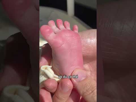 Tại sao trẻ sơ sinh lại nắm chặt bàn tay như vậy ? thumbnail