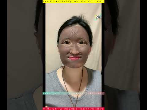 Amazing Face Glow Transformation – Simple Trick That Really Works!#FaceGlow #BeautyHack #GlowingSkin thumbnail
