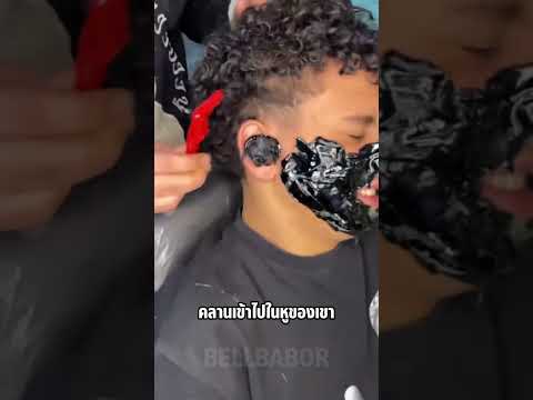 หมอยังเอาออกไม่ได้… thumbnail