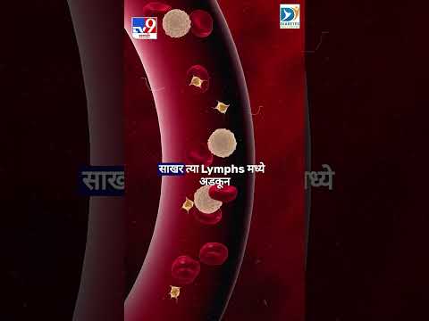 Dr. Bhagyesh Kulkarni l अधिक माहितीसाठी किंवा अपॉइंटमेंट बुक करण्यासाठी संपर्क... thumbnail