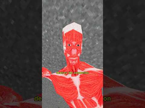 Locked-In Syndrome thumbnail