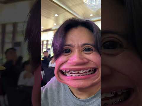 Tooth will be missed🦷😢🤣#BiboyBecky #BiboyAndBecky #shorts #skits #funny #comedy thumbnail