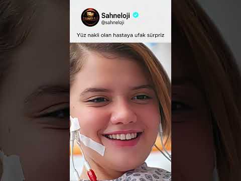 Yüz nakli olan hastaya ufak sürpriz thumbnail
