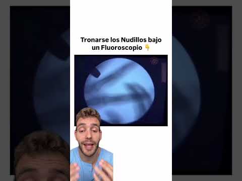 Crujirse los dedos #datoscurisos #sabiasque #anatomia thumbnail