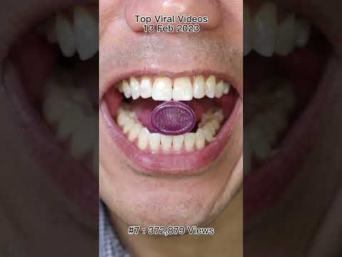 Satisfying Chewing ASMR #Compilation #ASMR #DoctorTristanPeh thumbnail
