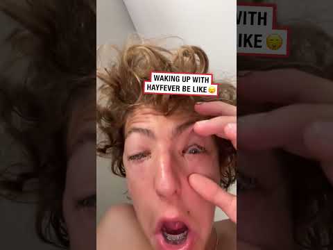 WMe all Summer 😂 thumbnail