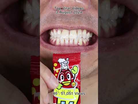 Satisfying Chewing ASMR #Compilation #ASMR #DoctorTristanPeh thumbnail