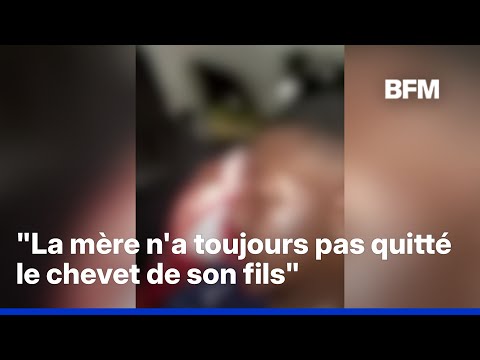 Bobigny: un jeune de 13 ans perd l'usage de son œil après avoir reçu un projectile, l'IGPN saisie thumbnail