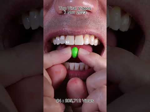 Satisfying Chewing ASMR #Compilation #ASMR #DoctorTristanPeh thumbnail