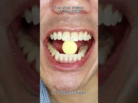 Satisfying Chewing ASMR #Compilation #ASMR #DoctorTristanPeh thumbnail