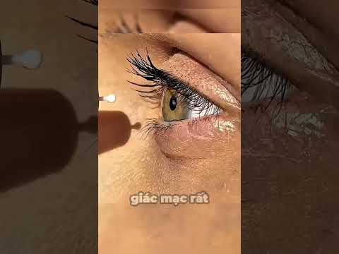 Kiểm tra áp lực mắt thumbnail