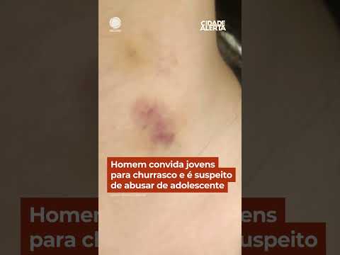 Homem convida jovens para churrasco e é suspeito de abusar de adolescente #Shorts #CidadeAlerta thumbnail