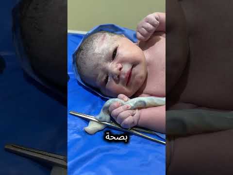 فعل الطفل شيئاً أذهل الجميع فور ولادته! 😲 thumbnail