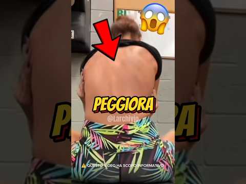 NON SOTTOVALUTARE IL MAL DI SCHIENA SE SEI GIOVANE 😱 #curiosità #informative thumbnail