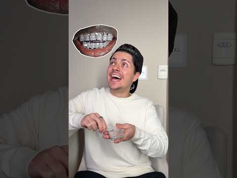 COLOQUEI DIAMANTES NOS DENTES? ?? thumbnail
