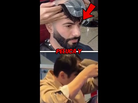 Le quitaron la peluca y envejeció 30 años en un segundo! thumbnail
