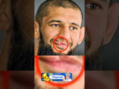 Как Хамзат Чимаев Получил Шрам thumbnail