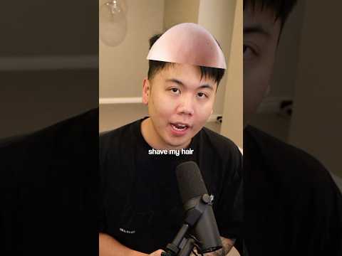 I Am Going BALD… thumbnail