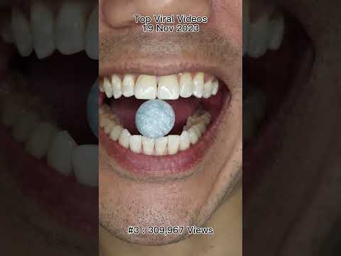 Satisfying Chewing ASMR #Compilation #ASMR #DoctorTristanPeh thumbnail
