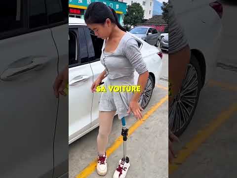 ?Elle utilise sa prothèse pour aller travailler thumbnail