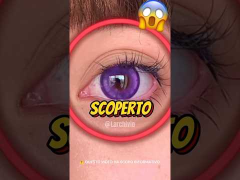 QUESTA SINDROME È ASSURDA MA...😱 #curiosità #informative thumbnail