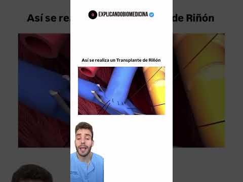 Transplante de riñon #datoscurisos #sabiasque #operacion thumbnail