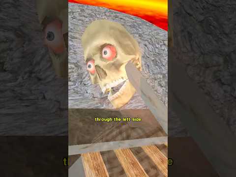 He Lived With A Hole In His Brain thumbnail